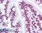 STAT3 antibody, LS-B1259, Lifespan Biosciences, Immunohistochemistry paraffin image 