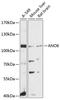 Anoctamin 6 antibody, 14-239, ProSci, Western Blot image 