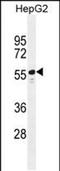 Tetratricopeptide Repeat Domain 6 antibody, PA5-48264, Invitrogen Antibodies, Western Blot image 