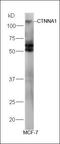 Catenin Alpha 3 antibody, orb10245, Biorbyt, Western Blot image 