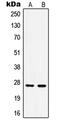 Heat Shock Protein Family B (Small) Member 1 antibody, GTX32195, GeneTex, Western Blot image 