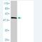 Collagen Type II Alpha 1 Chain antibody, H00001280-M01, Novus Biologicals, Western Blot image 