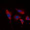 Inositol Polyphosphate-5-Phosphatase J antibody, orb256629, Biorbyt, Immunofluorescence image 