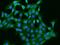 Phosphatidylinositol 4-Kinase Type 2 Beta antibody, 204170-T02, Sino Biological, Immunohistochemistry frozen image 