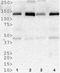 Histone Deacetylase 5 antibody, NBP2-22152, Novus Biologicals, Western Blot image 