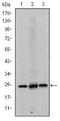 Eukaryotic Translation Initiation Factor 4E antibody, NBP2-22177, Novus Biologicals, Western Blot image 