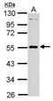MAGE Family Member B18 antibody, PA5-31830, Invitrogen Antibodies, Western Blot image 