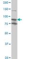 Ribosomal protein S6 kinase alpha-6 antibody, H00027330-M01, Novus Biologicals, Western Blot image 