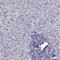 Transmembrane Channel Like 3 antibody, HPA040510, Atlas Antibodies, Immunohistochemistry paraffin image 