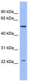 Poly(A) Binding Protein Cytoplasmic 1 Like 2B antibody, TA345733, Origene, Western Blot image 