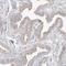 GNAS1 antibody, HPA028386, Atlas Antibodies, Immunohistochemistry paraffin image 
