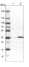 Nudix Hydrolase 5 antibody, NBP1-83131, Novus Biologicals, Western Blot image 