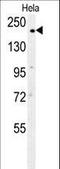 Clathrin Heavy Chain antibody, LS-C168861, Lifespan Biosciences, Western Blot image 