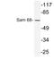 KH RNA Binding Domain Containing, Signal Transduction Associated 1 antibody, A01717-1, Boster Biological Technology, Western Blot image 