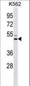 Lipase C, Hepatic Type antibody, LS-C165791, Lifespan Biosciences, Western Blot image 