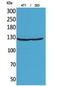 Integrin alpha-D antibody, A09283, Boster Biological Technology, Western Blot image 