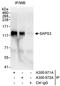 Serine/threonine-protein phosphatase 6 regulatory subunit 3 antibody, A300-971A, Bethyl Labs, Immunoprecipitation image 