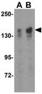 TBC1 Domain Family Member 1 antibody, GTX85437, GeneTex, Western Blot image 