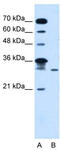 Glycolipid Transfer Protein Domain Containing 2 antibody, TA336090, Origene, Western Blot image 