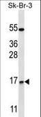 NOTCH Regulated Ankyrin Repeat Protein antibody, LS-C163002, Lifespan Biosciences, Western Blot image 