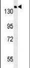 Sterile Alpha Motif Domain Containing 9 antibody, PA5-25613, Invitrogen Antibodies, Western Blot image 