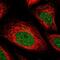 Interferon Gamma Receptor 2 antibody, NBP1-90223, Novus Biologicals, Immunofluorescence image 