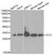 Enoyl-CoA delta isomerase 1, mitochondrial antibody, LS-C331354, Lifespan Biosciences, Western Blot image 