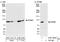 Karyopherin Subunit Beta 1 antibody, A301-803A, Bethyl Labs, Western Blot image 