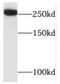 TATA-Box Binding Protein Associated Factor 1 Like antibody, FNab08483, FineTest, Western Blot image 