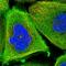 Trichoplein Keratin Filament Binding antibody, HPA038638, Atlas Antibodies, Immunocytochemistry image 