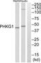 Phosphorylase Kinase Catalytic Subunit Gamma 1 antibody, abx015168, Abbexa, Western Blot image 