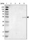 Serum/Glucocorticoid Regulated Kinase 2 antibody, PA5-52824, Invitrogen Antibodies, Western Blot image 