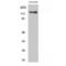 Telomerase Reverse Transcriptase antibody, LS-C386388, Lifespan Biosciences, Western Blot image 