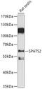 Spermatogenesis Associated Serine Rich 2 antibody, 18-091, ProSci, Western Blot image 