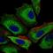Interleukin 3 Receptor Subunit Alpha antibody, NBP2-37354, Novus Biologicals, Immunocytochemistry image 