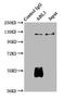 ABL Proto-Oncogene 1, Non-Receptor Tyrosine Kinase antibody, LS-C211656, Lifespan Biosciences, Immunoprecipitation image 