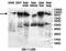 Pitrilysin Metallopeptidase 1 antibody, orb78148, Biorbyt, Western Blot image 