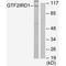 GTF2I Repeat Domain Containing 1 antibody, PA5-49893, Invitrogen Antibodies, Western Blot image 