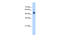 Glucosaminyl (N-Acetyl) Transferase 3, Mucin Type antibody, 29-880, ProSci, Western Blot image 