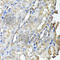 SCY1 Like Pseudokinase 1 antibody, A6735, ABclonal Technology, Immunohistochemistry paraffin image 