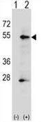 P-LAP antibody, AP50155PU-N, Origene, Western Blot image 