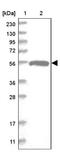 Cilia And Flagella Associated Protein 52 antibody, NBP1-81947, Novus Biologicals, Western Blot image 