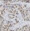 Casein Kinase 1 Epsilon antibody, FNab01280, FineTest, Immunohistochemistry paraffin image 