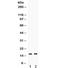 Transthyretin antibody, R31903, NSJ Bioreagents, Western Blot image 