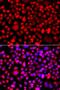 Chitobiosyldiphosphodolichol beta-mannosyltransferase antibody, orb373785, Biorbyt, Immunocytochemistry image 