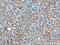 Aspartate Beta-Hydroxylase antibody, 14116-1-AP, Proteintech Group, Immunohistochemistry paraffin image 