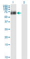 Receptor Interacting Serine/Threonine Kinase 2 antibody, LS-C133569, Lifespan Biosciences, Western Blot image 