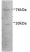 DEAD-Box Helicase 41 antibody, 43-523, ProSci, Enzyme Linked Immunosorbent Assay image 