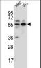 NEDD8 Activating Enzyme E1 Subunit 1 antibody, LS-C164736, Lifespan Biosciences, Western Blot image 