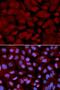 O-Linked N-Acetylglucosamine (GlcNAc) Transferase antibody, LS-B13864, Lifespan Biosciences, Immunofluorescence image 